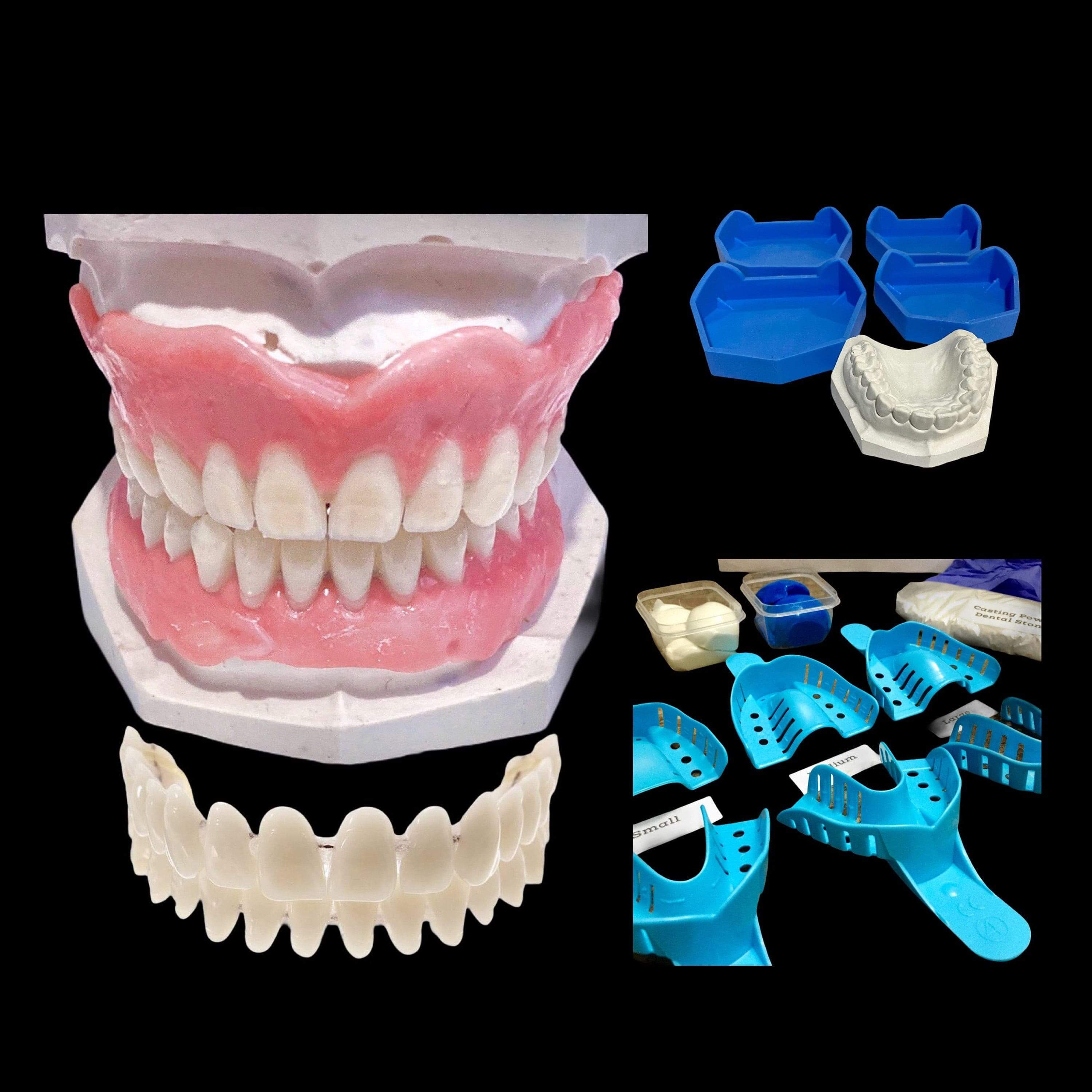 Dental Impression Kit With Putty Quick & Easy Teeth Mould and Cast Make  Your Own Upper Lower Tooth Mold at Home Custom DIY Mouth Model 
