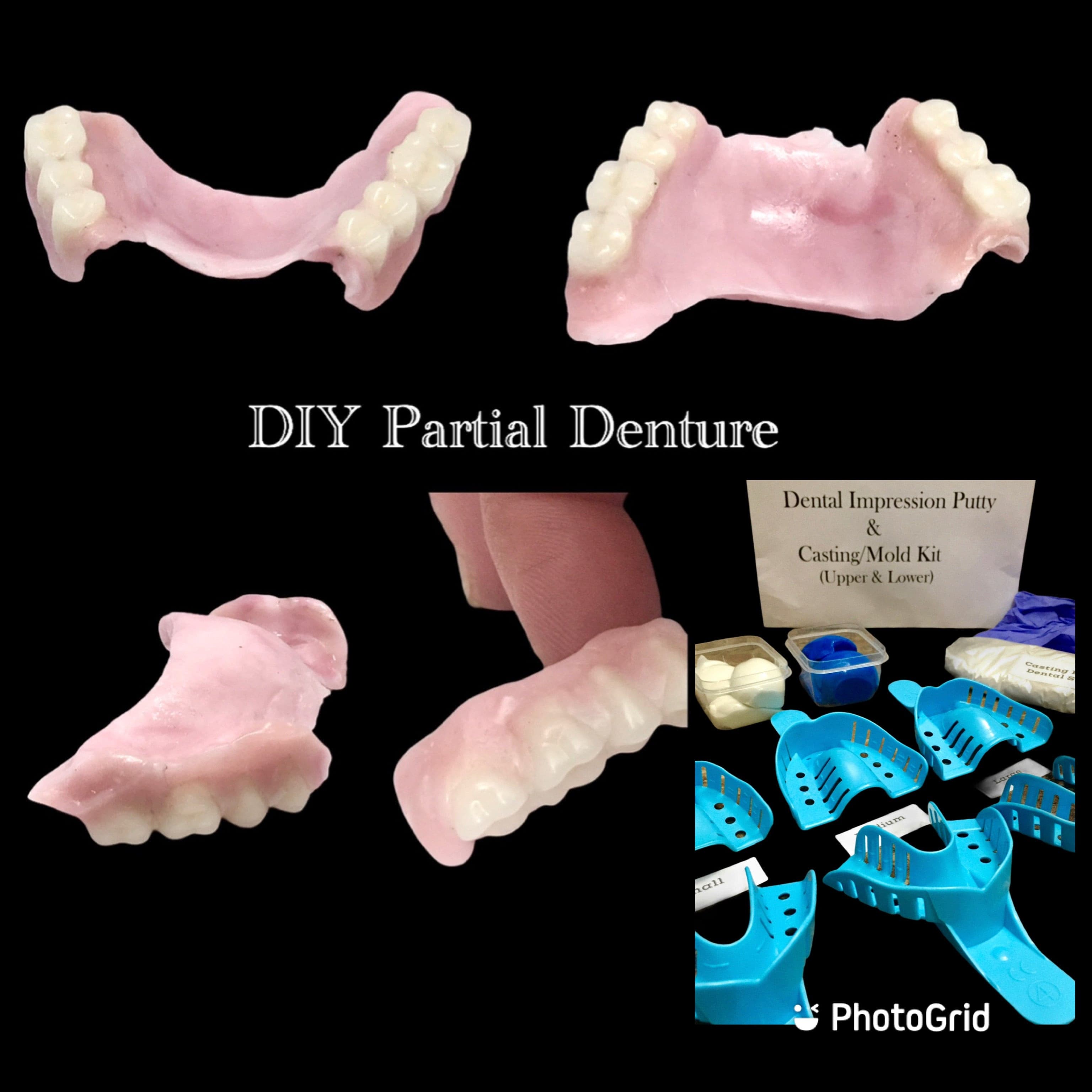 Dental Impression Kit With Putty Quick & Easy Teeth Mould and Cast Make  Your Own Upper Lower Tooth Mold at Home Custom DIY Mouth Model 