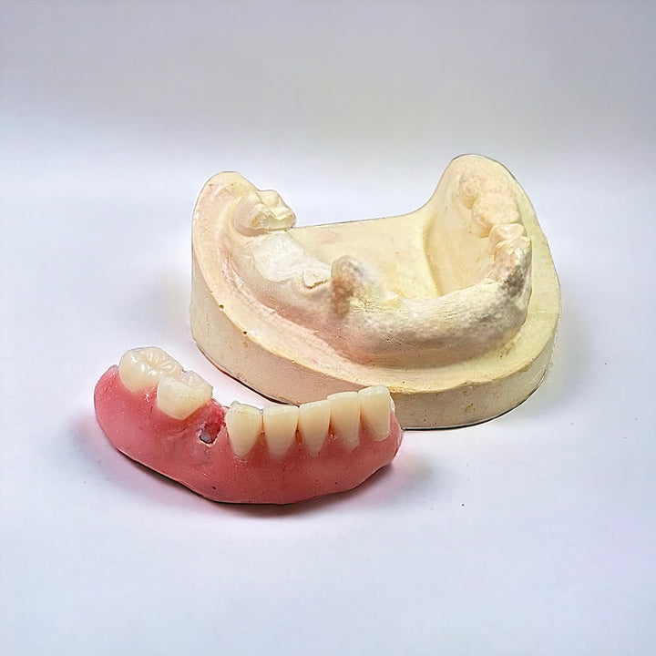 Upper jaw dental mold next to a DIY partial denture model with artificial teeth on a white background.