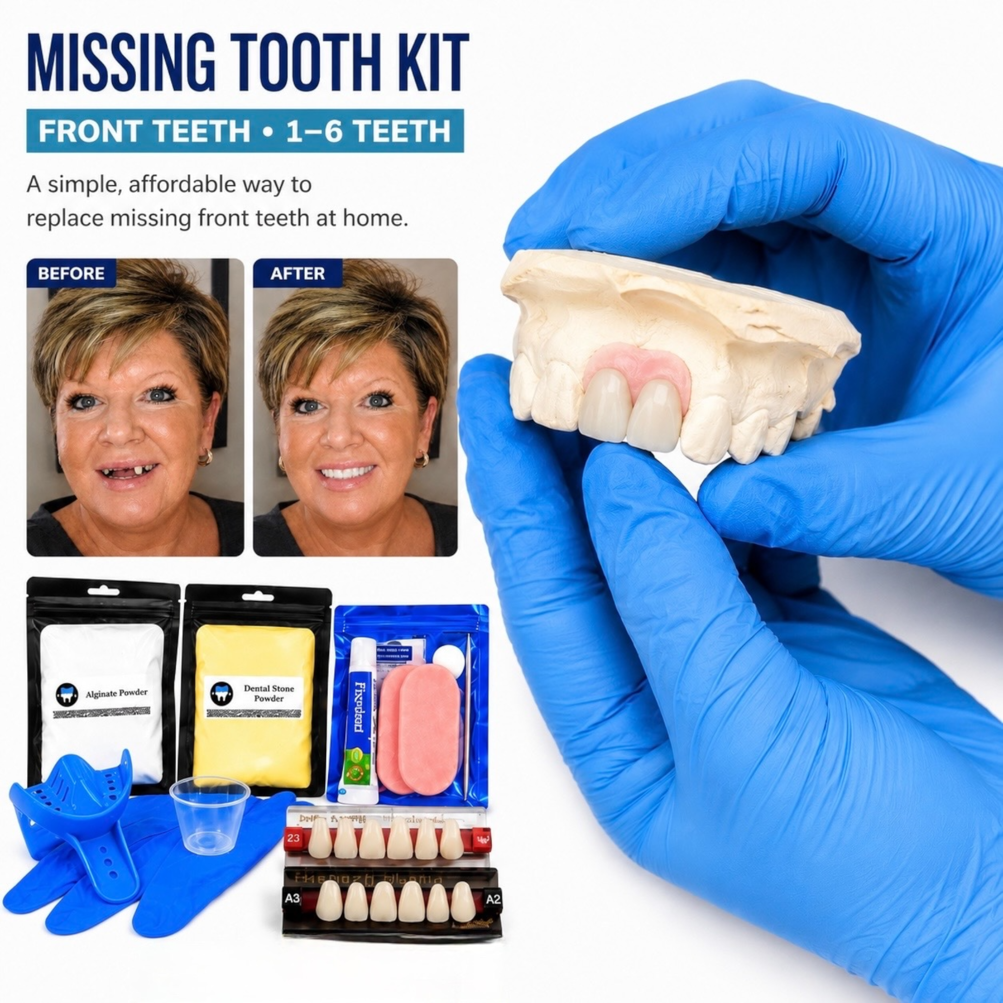 Missing Front Tooth Kit | Replace Up to 6 Upper Teeth at Home – DIY ...