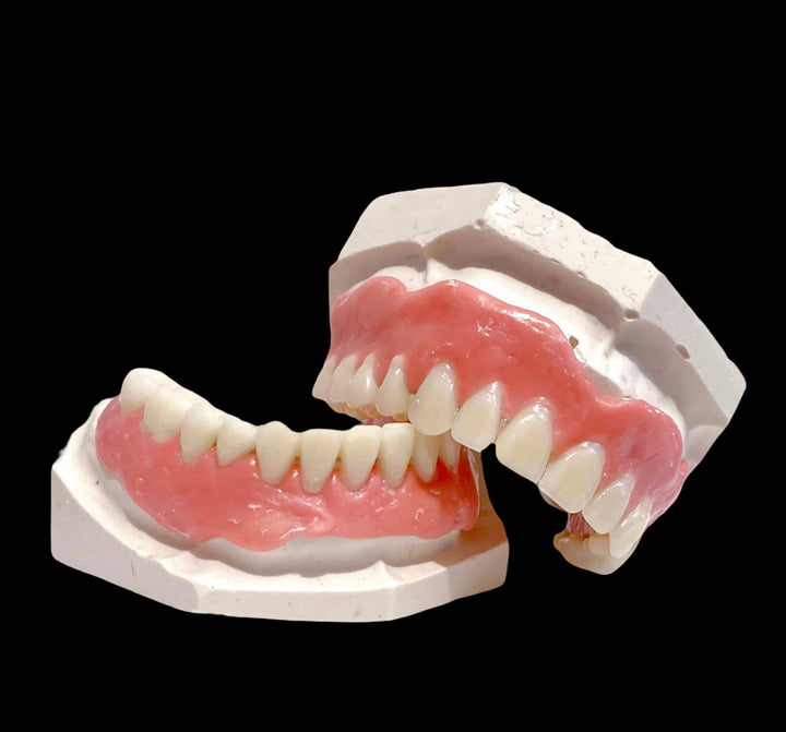 DIY Beginner Smile Kit/ Putty Impression Upper Lower Full Set/ Make Partial Everything You Need - DIY Denture Shop LLC ™