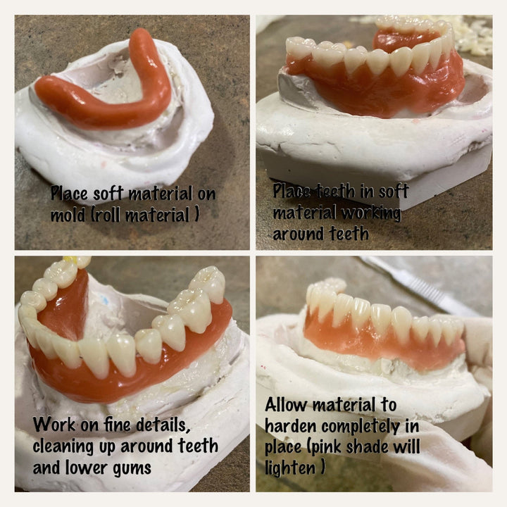 DIY Beginner Smile Kit/ Putty Impression Upper Lower Full Set/ Make Partial Everything You Need - DIY Denture Shop LLC ™