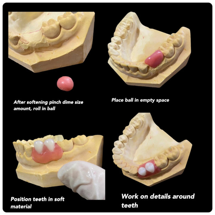 DIY Partial Denture False Teeth Kit No Impression - DIY Denture Shop LLC ™