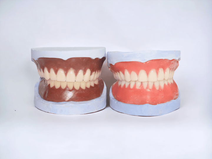 DIY Partial Denture False Teeth Kit No Impression - DIY Denture Shop LLC ™