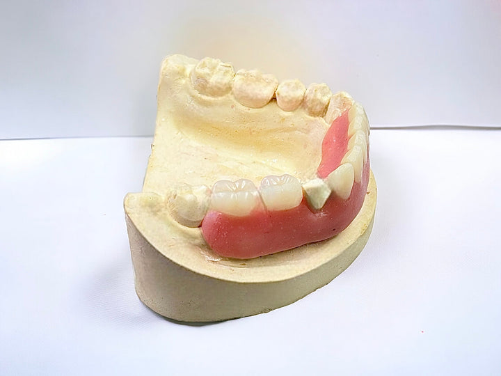 DIY Partial Denture False Teeth Kit No Impression - DIY Denture Shop LLC ™