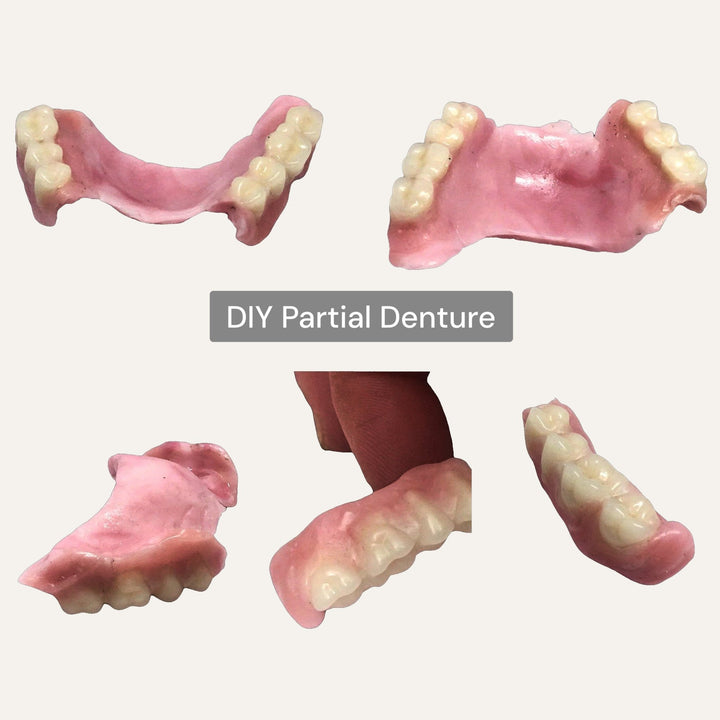 DIY Partial Denture False Teeth Kit No Impression - DIY Denture Shop LLC ™