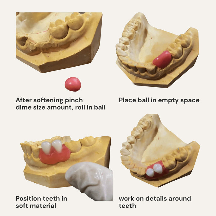 DIY Partial Denture False Teeth Kit No Impression - DIY Denture Shop LLC ™