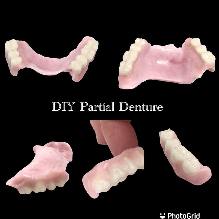 DIY Partial Denture False Teeth Kit No Impression - DIY Denture Shop LLC ™