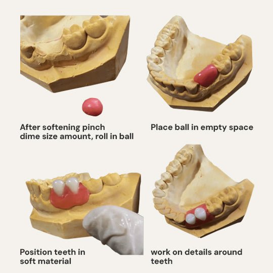 DIY Partial Denture Kit with Dental Impression Kit - DIY Denture Shop LLC ™