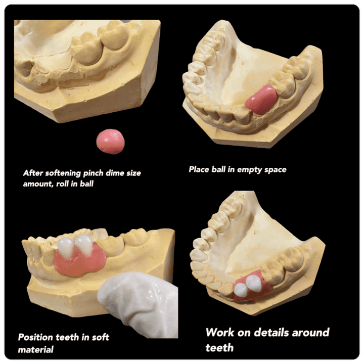 DIY Partial Denture Kit with Dental Impression Kit - DIY Denture Shop LLC ™