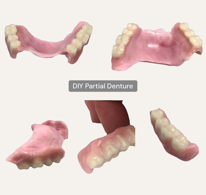 DIY Partial Denture Kit with Dental Impression Kit - DIY Denture Shop LLC ™