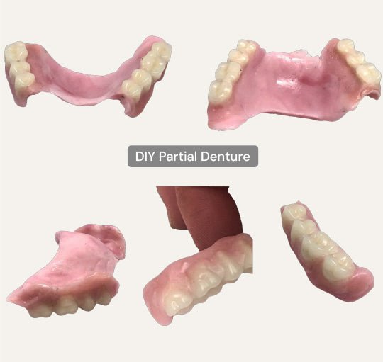 DIY Partial Denture Kit with Dental Impression Kit - DIY Denture Shop LLC ™