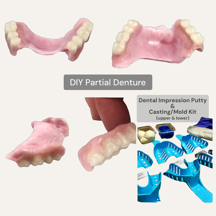 DIY Partial Denture Kit with Dental Impression Kit - DIY Denture Shop LLC ™