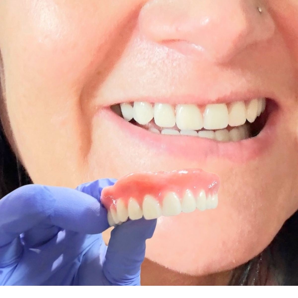 Secure Smile DIY Denture Reline Kit Gum Material - DIY Denture Shop LLC ™