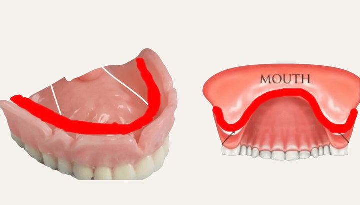 Secure Smile DIY Denture Reline Kit Gum Material - DIY Denture Shop LLC ™