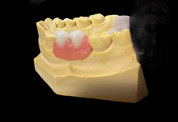 Tooth Replacement Kit with Alginate Impression Materials - DIY Denture Shop LLC ™