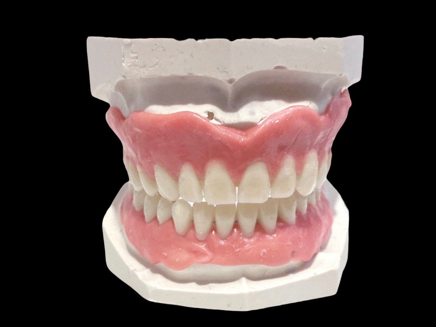 DIY Partial Denture Kit - Dental Putty Impression Kit