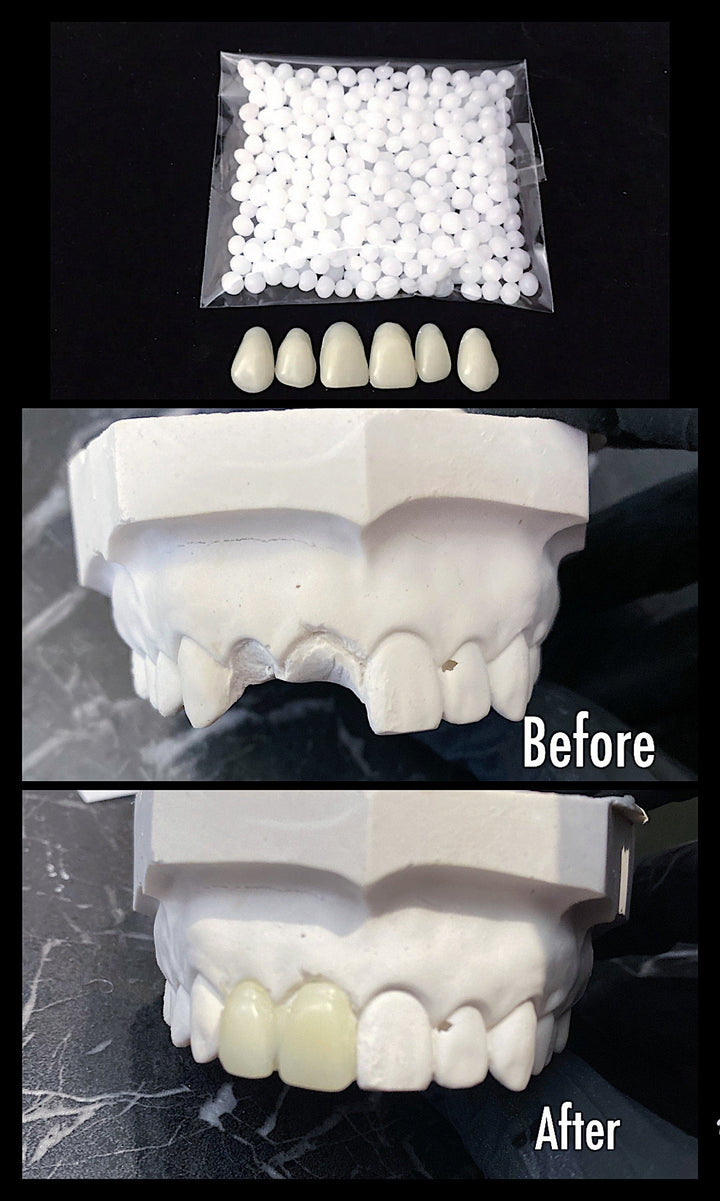 Home Dental Tooth Repair