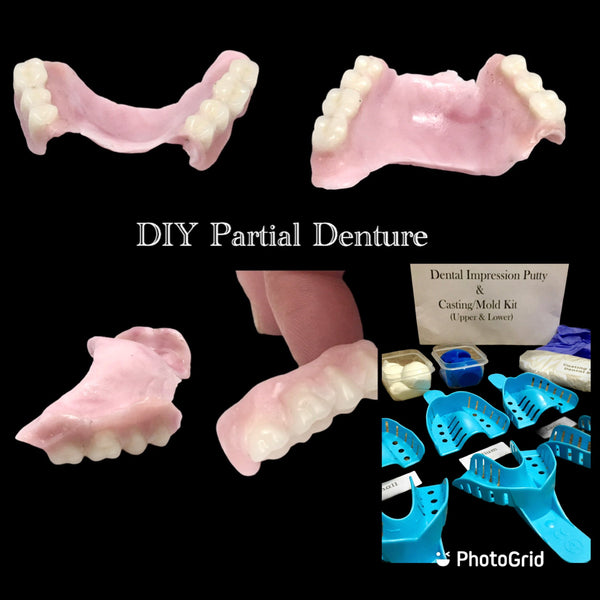 DIY Partial Denture Kit 