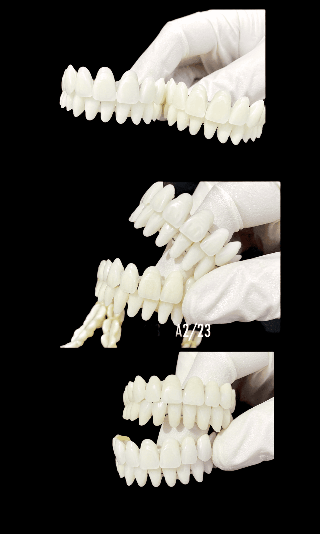 DIY DENTURE KIT Custom Homemade Dentures Dental Resin Denture False Teeth - AbuMaizar  Dental Roots Clinic
